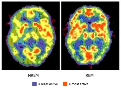 Brain activity before and during REM Sleep